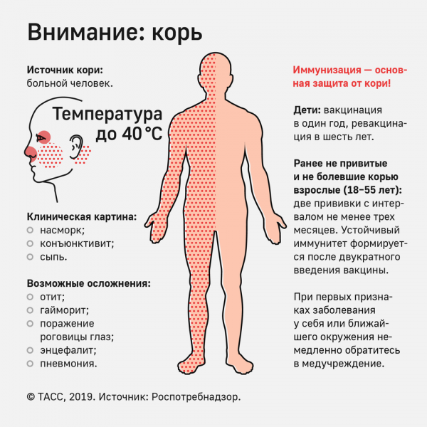 В Петербурге третий год подряд наблюдается подъем заболеваемости корью  