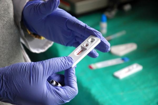 51 тыс. жителей Химок прошли тестирование на наличие ВИЧ-инфекции в 2019 году