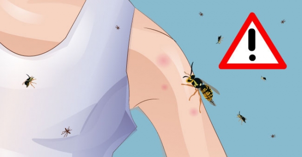Главный внештатный педиатр рассказала химчанам, чем опасны укусы насекомых 