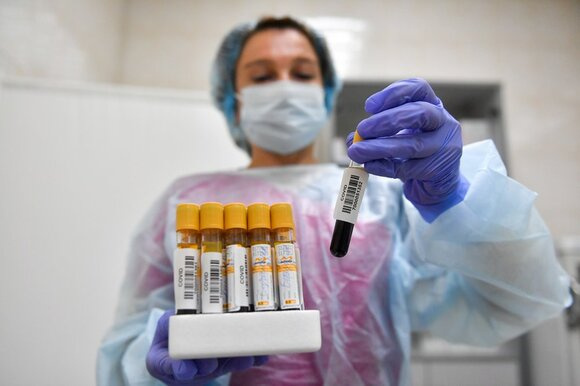 Более 2 млн жителей Подмосковья прошли ПЦР-исследование на коронавирус