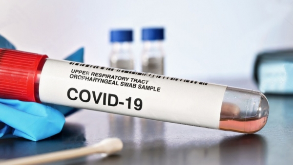 Еще 472 новых случая Covid-19 выявили в Московской области за сутки