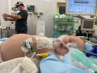 В Центре Блохина успешно прооперировали ребенка с опухолью весом 20% массы тела