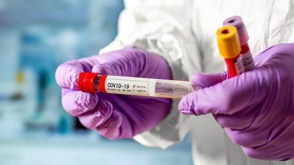 Свыше 550 новых случаев коронавируса выявили в Подмосковье за сутки