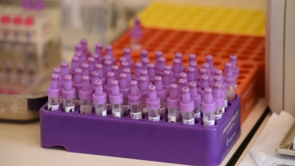 Более 860 случаев коронавируса выявили в Подмосковье за сутки