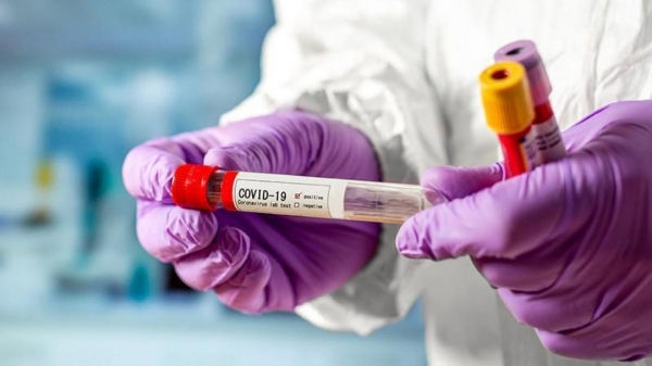 Более 35 тыс. ПЦР-тестов на коронавирус в сутки проводят в Подмосковье