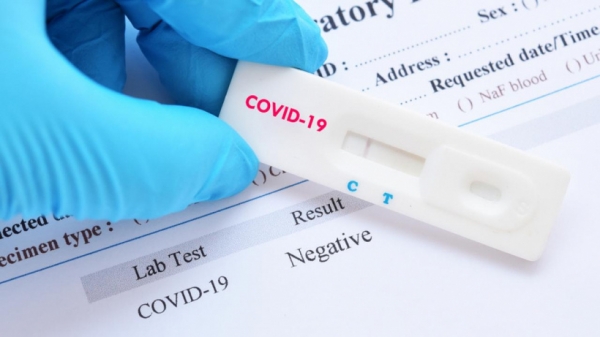 Уточнены порядок лабораторного исследования на COVID-19 и выписки пациентов