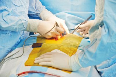 В Сеченовском университете пациентке удалили опухоль и заменили фрагменты сердца