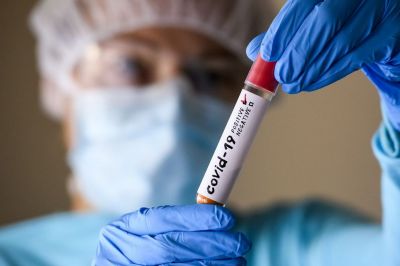 Эксперт ВОЗ спрогнозировал более тяжелый второй год пандемии коронавируса