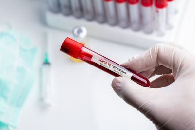Среди готовых к регистрации отечественных тест-систем одна определяет «британский» коронавирус