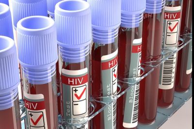Пациенты рассказали о недостаточном количестве закупок тестов для мониторинга лечения ВИЧ